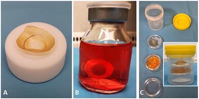 Ultrastructural Analysis of Rehydrated Human Donor Corneas After Air-Drying and Dissection by Femtosecond Laser